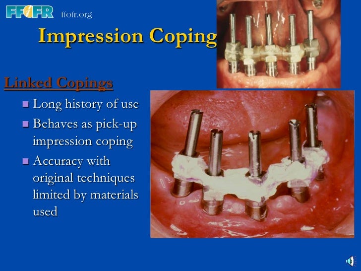 3.implant components and basic techniques3