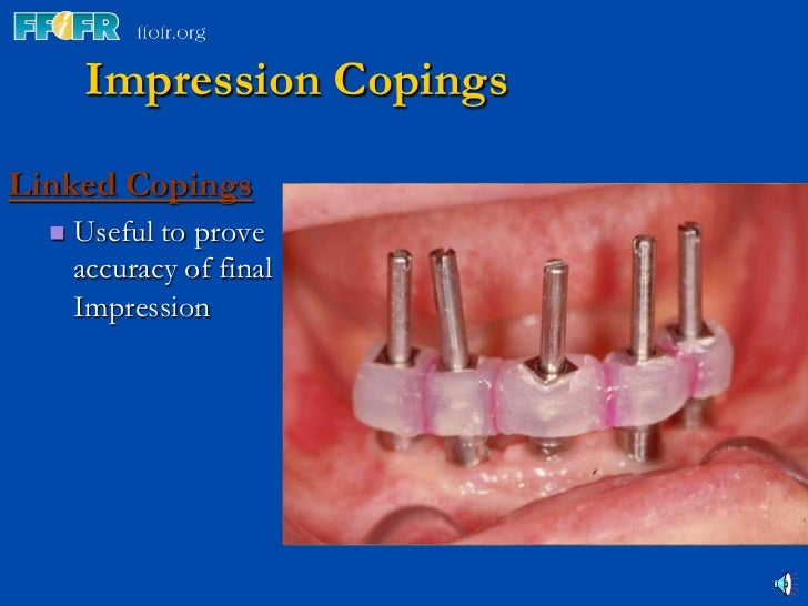 3.implant components and basic techniques3