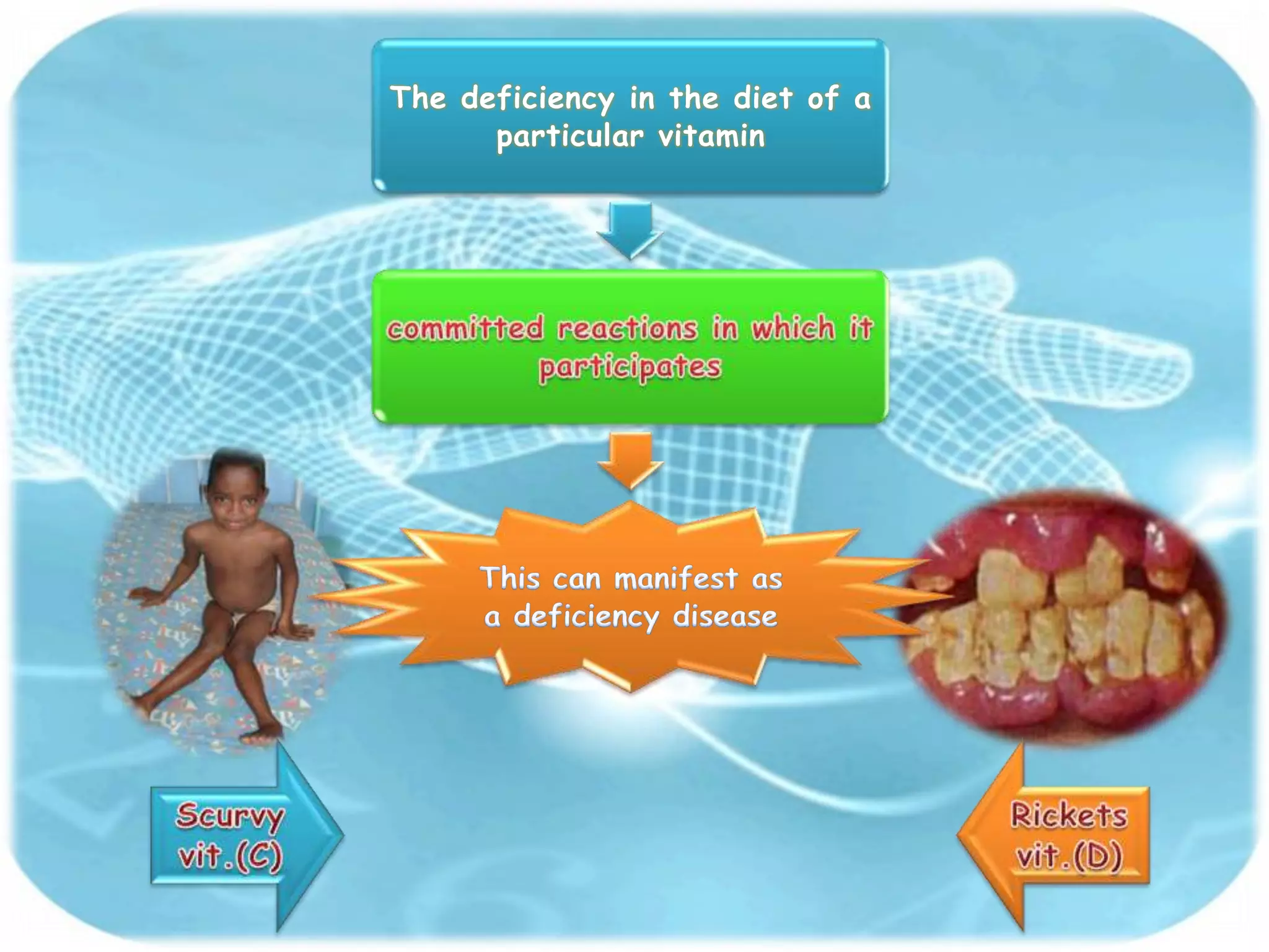 The deficiency in the diet of a
      particular vitamin
 