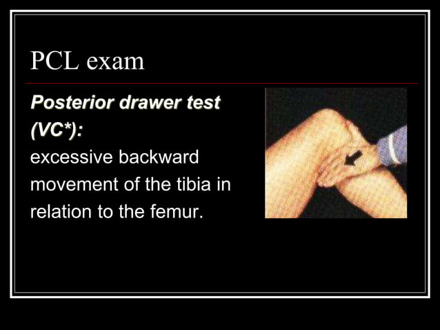 3-Knee Examination.ppt | Free Download