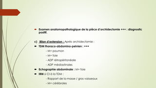  Examen anatomopathologique de la pièce d’orchidectomie +++ : diagnostic
positif.
c) Bilan d’extension : Après orchidectomie :
 TDM thoraco-abdomino-pelvien : +++
- M+ poumon
- M+ foie
- ADP rétropéritonéale
- ADP médiastinales
 Echographie abdominale : M+ foie
 IRM si CI à la TDM :
- Rapport de la masse / gros vaisseaux
- M+ cérébrales
 