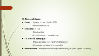 11. Formes cliniques :
 Enfant : - Tumeur du sac vitellin (60%)
- Tératome mature
 Bilatérale : 2 – 5%
- Simultanées
- Consécutives : surveillance
 Sur testicule ectopique :
- Diagnostic souvent tardif : métastases+++
- Masse abdominale + bourse vide
 Inflammatoire : masque une orchiépididymite aigue (sans signes urinaires)
 