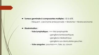  Tumeur germinale à composantes multiples : 50 à 60%
- Fréquent : carcinome embryonnaire + tératome = tératocarcinome
 Dissémination :
- Voie lymphatique : +++ très lymphophile
- ganglions lomboaortiques
- ganglions médiastinaux
- ganglions sus-claviculaires gauches
- Voie sanguine : poumon+++, foie, os, cavum
 