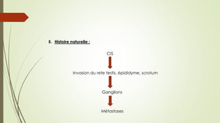 5. Histoire naturelle :
CIS
Invasion du rete testis, épididyme, scrotum
Ganglions
Métastases
 