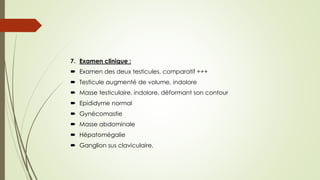 7. Examen clinique :
 Examen des deux testicules, comparatif +++
 Testicule augmenté de volume, indolore
 Masse testiculaire, indolore, déformant son contour
 Epididyme normal
 Gynécomastie
 Masse abdominale
 Hépatomégalie
 Ganglion sus claviculaire.
 