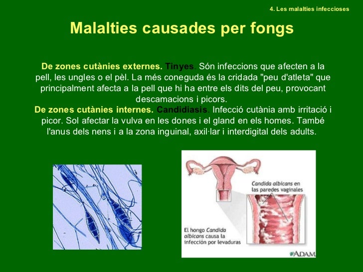 Resultado de imagen de FONGS MALALTIA