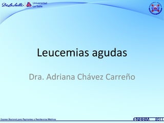 Leucemias agudas
Dra. Adriana Chávez Carreño
 