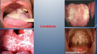 3-Major Manifestations of GIT Disease.ppt