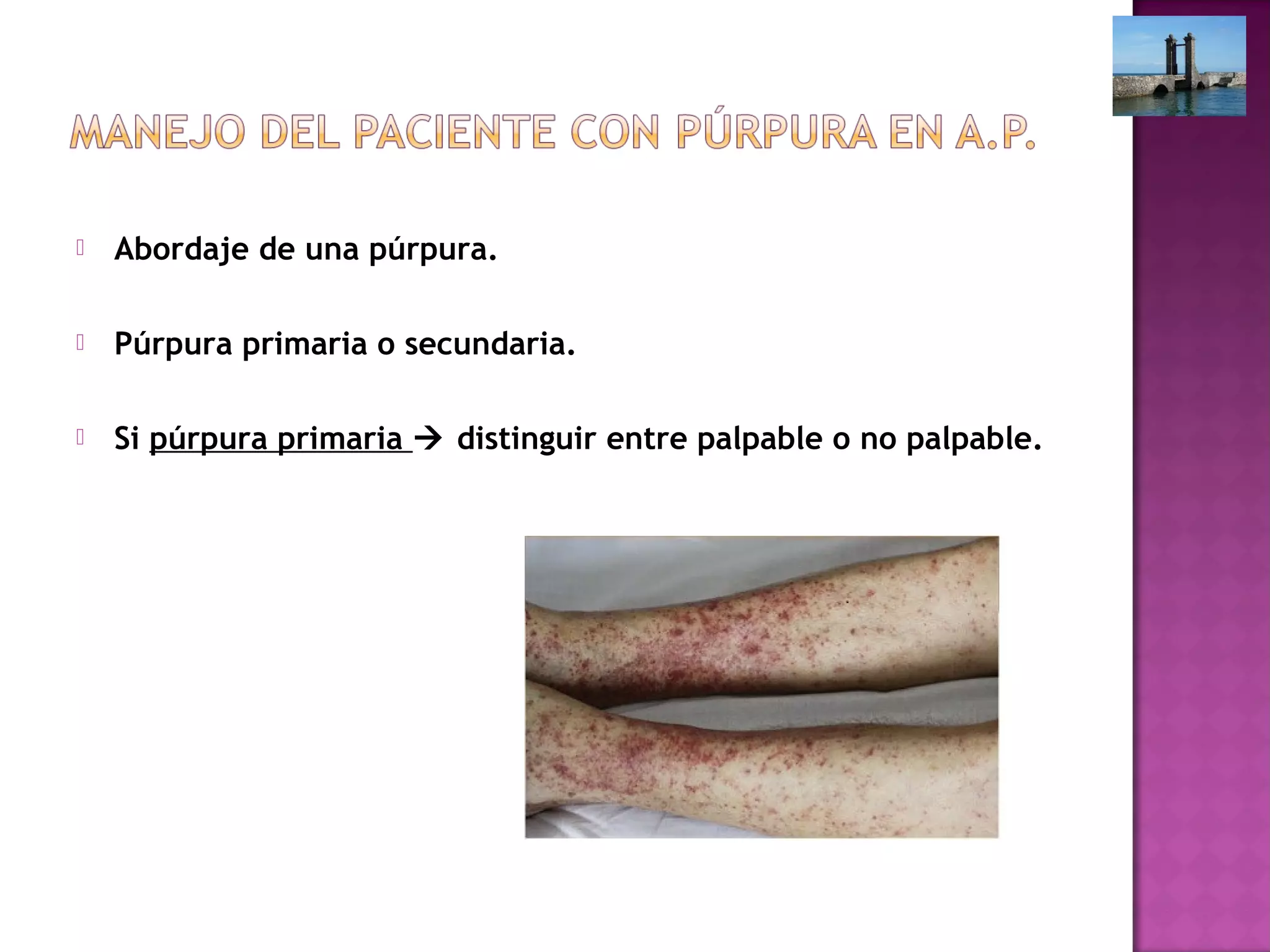 Abordaje de una púrpura.
 Púrpura primaria o secundaria.
 Si púrpura primaria  distinguir entre palpable o no palpable.
 