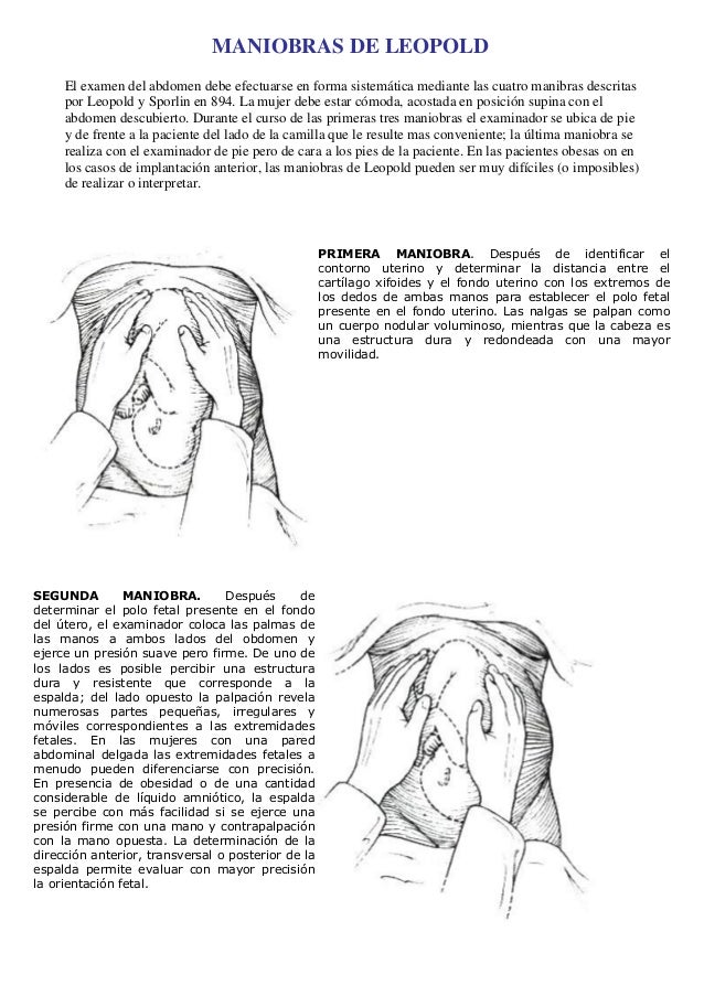 maniobras de leopold