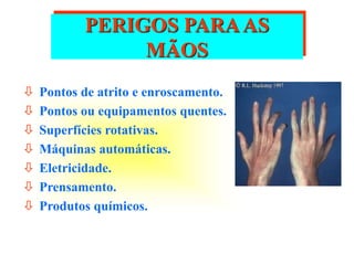 PERIGOS PARAAS
MÃOS
 Pontos de atrito e enroscamento.
 Pontos ou equipamentos quentes.
 Superfícies rotativas.
 Máquinas automáticas.
 Eletricidade.
 Prensamento.
 Produtos químicos.
 