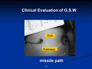 Clinical Evaluation of G.S.W.
Exit
Entrance
missile path
110
 