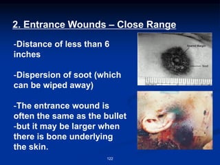 2. Entrance Wounds – Close Range
-Distance of less than 6
inches
-Dispersion of soot (which
can be wiped away)
-The entrance wound is
often the same as the bullet
-but it may be larger when
there is bone underlying
the skin.
122
 