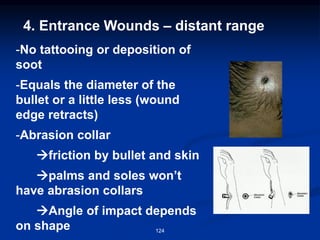 4. Entrance Wounds – distant range
-No tattooing or deposition of
soot
-Equals the diameter of the
bullet or a little less (wound
edge retracts)
-Abrasion collar
→friction by bullet and skin
→palms and soles won’t
have abrasion collars
→Angle of impact depends
on shape 124
 