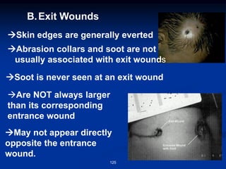 B.Exit Wounds
→Skin edges are generally everted
→Abrasion collars and soot are not
usually associated with exit wounds
→Soot is never seen at an exit wound
→Are NOT always larger
than its corresponding
entrance wound
→May not appear directly
opposite the entrance
wound.
125
 