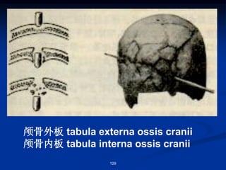 颅骨外板 tabula externa ossis cranii
颅骨内板 tabula interna ossis cranii
129
 