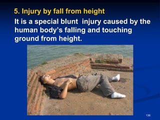 5. Injury by fall from height
It is a special blunt injury caused by the
human body’s falling and touching
ground from height.
136
 