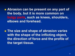 ◼ Abrasion can be present on any part of
the body, but it is more common on
bulgy parts, such as knees, shoulders,
elbows and forehead.
◼ The size and shape of abrasion varies
with the shape of the inflicting object,
the direction of force and the profile of
the target tissue.
17
 