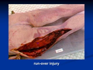 run-over injury
 