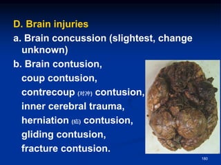 D. Brain injuries
a. Brain concussion (slightest, change
unknown)
b. Brain contusion,
coup contusion,
contrecoup (对冲) contusion,
inner cerebral trauma,
herniation (疝) contusion,
gliding contusion,
fracture contusion.
180
 