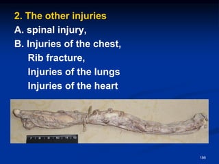 2. The other injuries
A. spinal injury,
B. Injuries of the chest,
Rib fracture,
Injuries of the lungs
Injuries of the heart
186
 