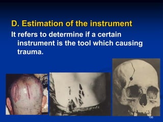 D. Estimation of the instrument
It refers to determine if a certain
instrument is the tool which causing
trauma.
196
 