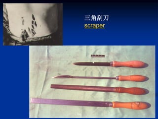 198
三角刮刀
scraper
 