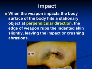 impact
◼ When the weapon impacts the body
surface of the body hits a stationary
object at perpendicular direction, the
edge of weapon rubs the indented skin
slightly, leaving the impact or crushing
abrasions.
21
 