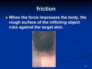 friction
◼ When the force impresses the body, the
rough surface of the inflicting object
rubs against the target skin.
22
 