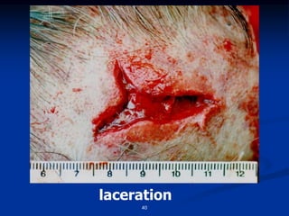 laceration
40
 