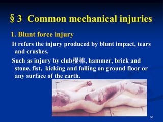 §3 Common mechanical injuries
1. Blunt force injury
It refers the injury produced by blunt impact, tears
and crushes.
Such as injury by club棍棒, hammer, brick and
stone, fist, kicking and falling on ground floor or
any surface of the earth.
56
 