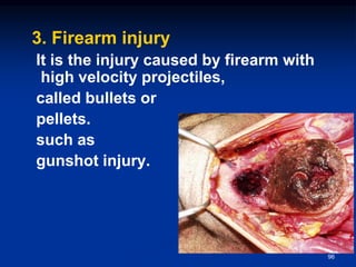 3. Firearm injury
It is the injury caused by firearm with
high velocity projectiles,
called bullets or
pellets.
such as
gunshot injury.
96
 