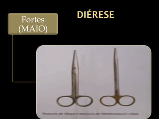 DIÉRESE
Fortes
(MAIO)
 