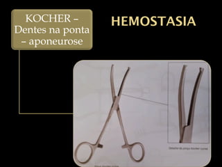 HEMOSTASIA
KOCHER –
Dentes na ponta
– aponeurose
 