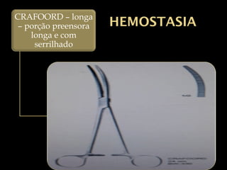 HEMOSTASIA
CRAFOORD – longa
– porção preensora
longa e com
serrilhado
 