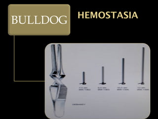 HEMOSTASIA
BULLDOG
 