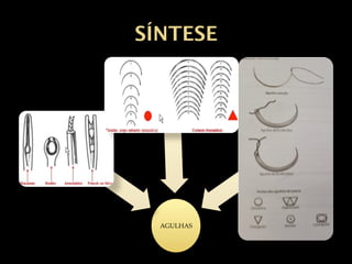 SÍNTESE
AGULHAS
 