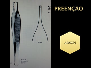 PREENÇÃO
ADSON
 
