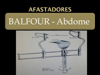 AFASTADORES
BALFOUR - Abdome
 