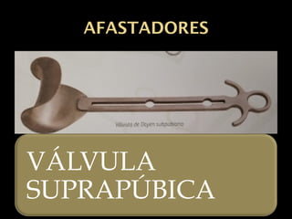AFASTADORES
VÁLVULA
SUPRAPÚBICA
 
