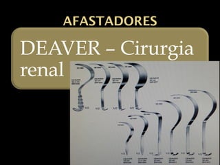 AFASTADORES
DEAVER – Cirurgia
renal
 