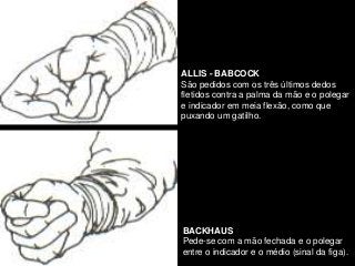 ALLIS - BABCOCK
São pedidos com os três últimos dedos
fletidos contra a palma da mão e o polegar
e indicador em meia flexão, como que
puxando um gatilho.
BACKHAUS
Pede-se com a mão fechada e o polegar
entre o indicador e o médio (sinal da figa).
 
