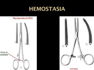 HEMOSTASIAHalsted (mosquito)
– mais delicado,
campo superficial
e são pequenas.
 