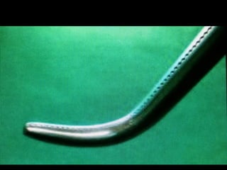 HEMOSTASIAKOCHER –
Dentes na ponta
– aponeurose
 