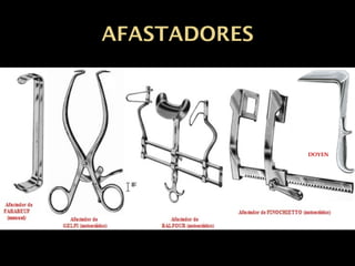 AFASTADORES
FINOCHIETTO - Tórax
 