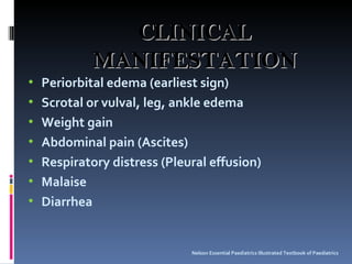 Periorbital edema (earliest sign) Scrotal or vulval, leg, ankle edema Weight gain Abdominal pain (Ascites) Respiratory distress (Pleural effusion) Malaise Diarrhea Nelson Essential Paediatrics Illustrated Textbook of Paediatrics CLINICAL MANIFESTATION 