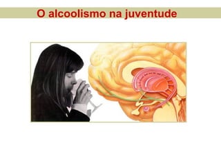 O alcoolismo na juventude
 