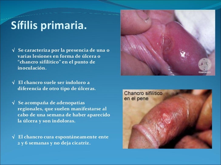 Los tipos de las operaciones al miembro viril a los niños