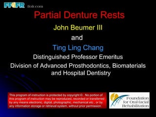 Partial Denture Rests
                               John Beumer III
                                     and
                               Ting Ling Chang
         Distinguished Professor Emeritus
Division of Advanced Prosthodontics, Biomaterials
                and Hospital Dentistry


This program of instruction is protected by copyright ©. No portion of
this program of instruction may be reproduced, recorded or transferred
by any means electronic, digital, photographic, mechanical etc., or by
any information storage or retrieval system, without prior permission.
 