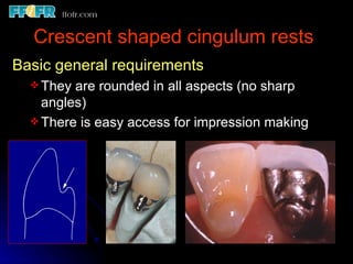 3.partial denture rests | PPT